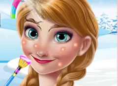 Frozen Anna Limpeza de Pele 2